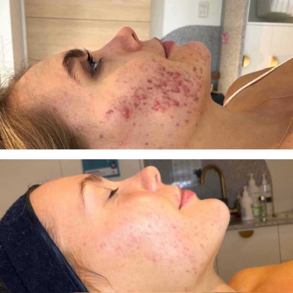 Client skin results