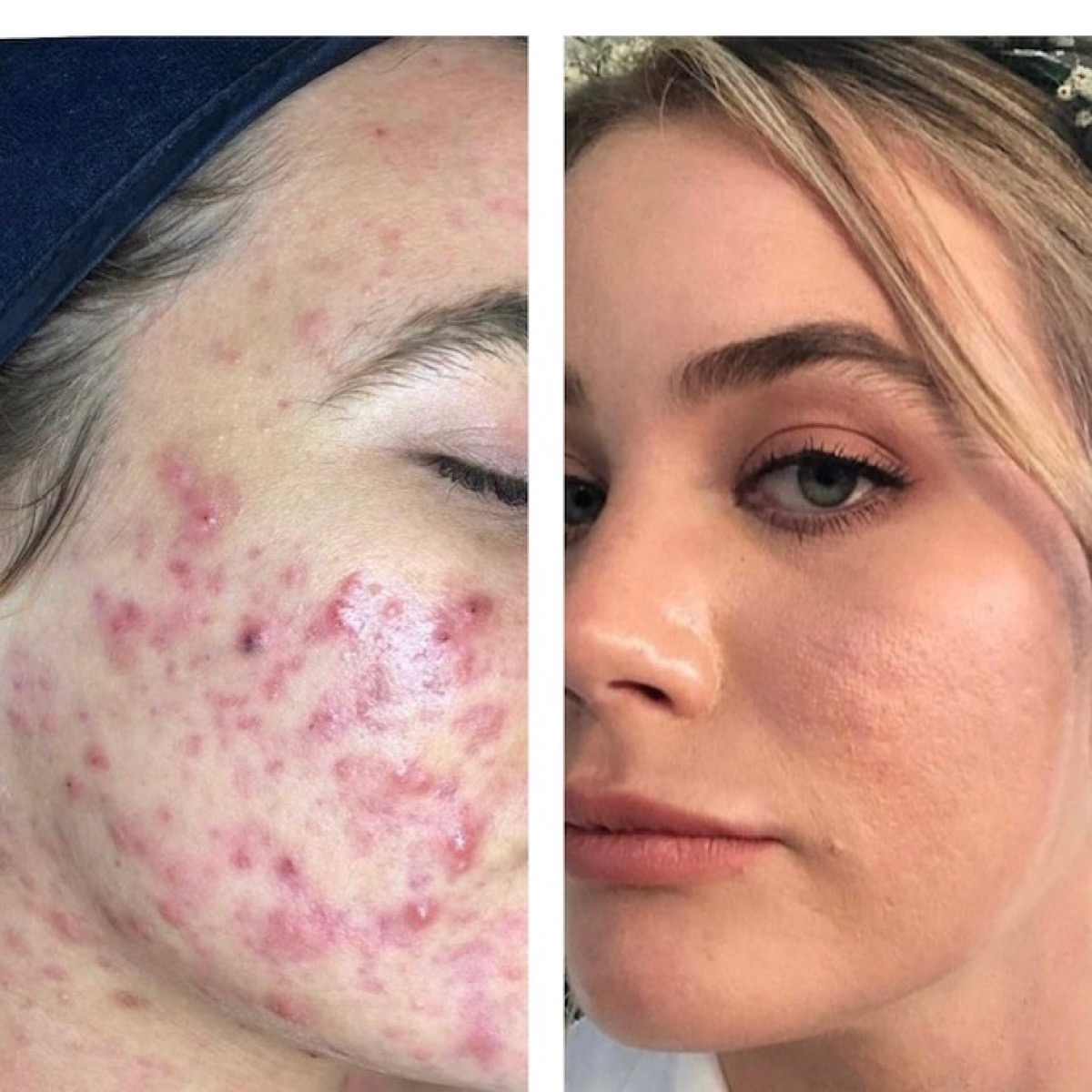 Client skin results