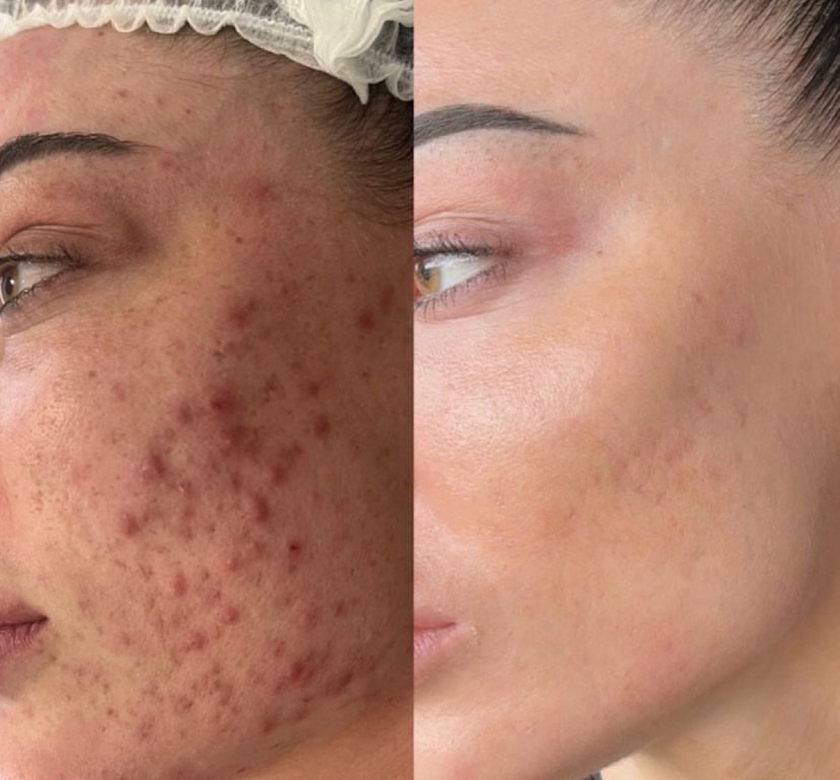 Client skin results