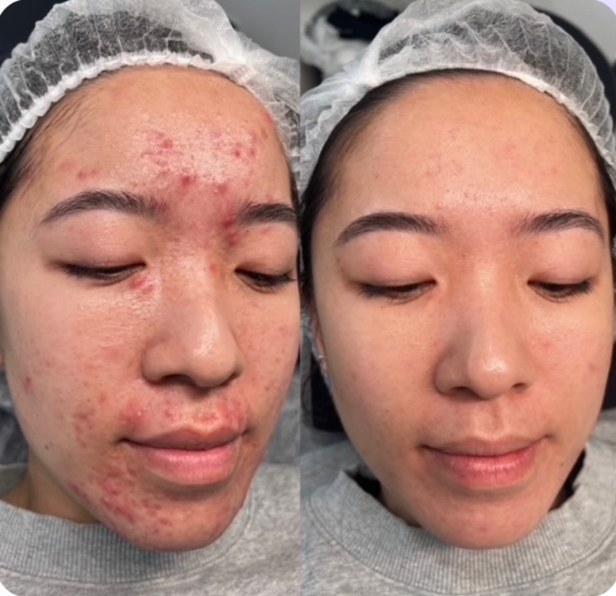 Client skin results