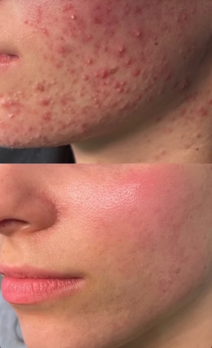 Client skin results