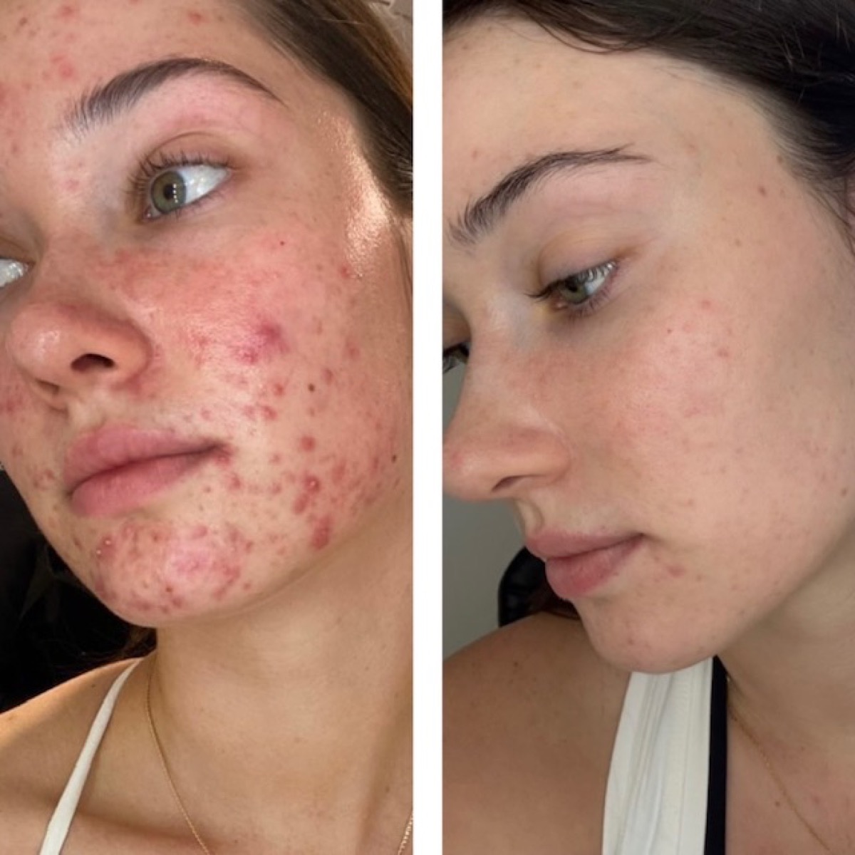 Client skin results